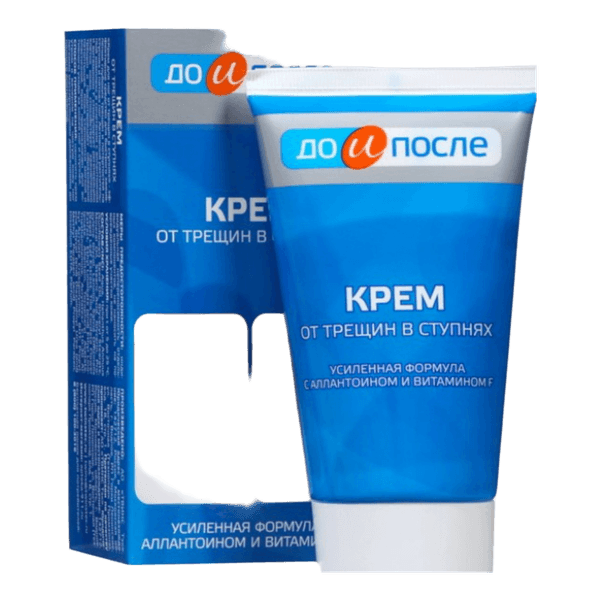 Pėdų kremas nuo įtrūkimų